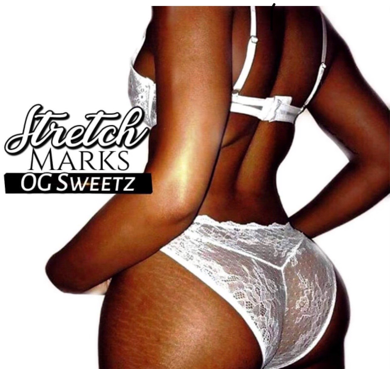 Stretch Marks